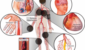 Humacyte’s AV Access Study shows promising results